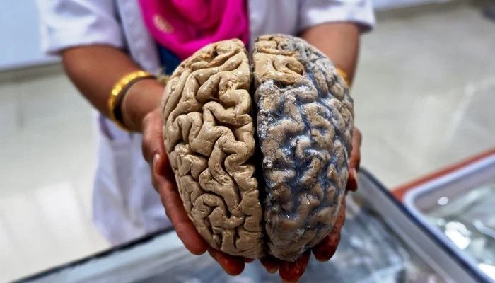 Human Brain Is Actually Two Separate Organs Stanford Study Finds