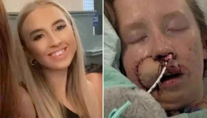 Woman Mauled By Dog She Knew Since Puppyhood Faces Years Of Surgery