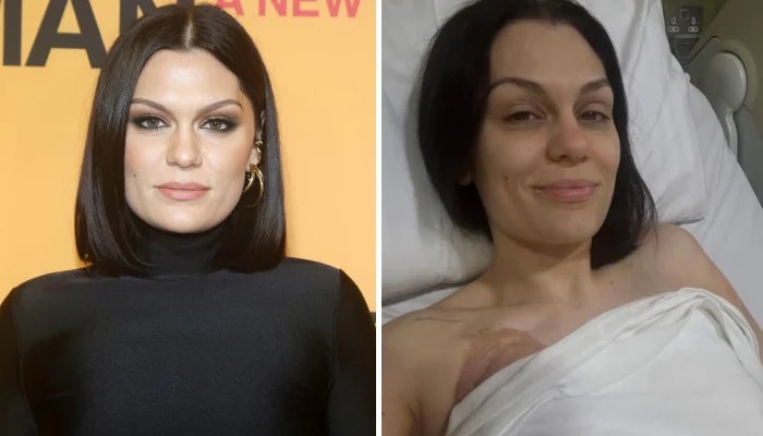 Jessie J Steps Away From Spotlight Ahead of Second Cancer Surgery