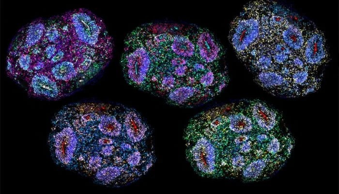 Scientists Grow Human Brain Tissues In Lab For Seven Years In Stunning Breakthrough
