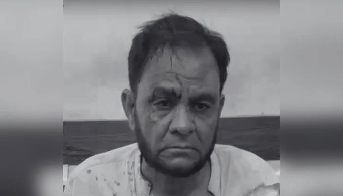 KU Professor Assaulted, Pistol-Whipped by Hotel Owner’s Son in Karachi
