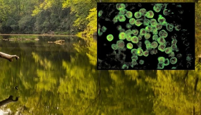 How Did Nc Teen Catch Brain Eating Amoeba Know Every Detail Here