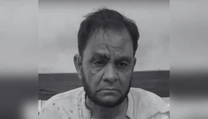 Prime suspect gets interim bail in KU professor assault case