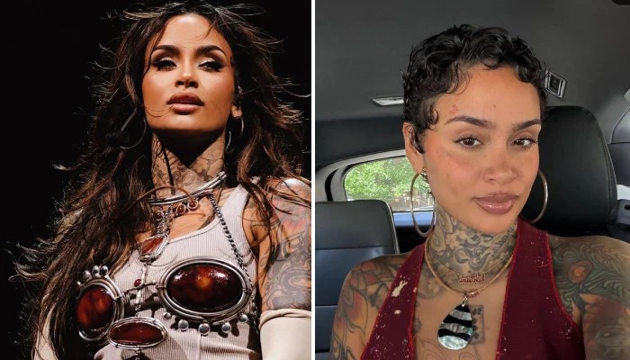 Kehlani hospitalized hours ahead of concert: 'In so much pain'