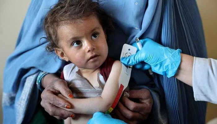 One Million Afghan Children Facing Life-Threatening Malnutrition, UN Warns